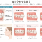 顎のズレは“位置の問題”ではなく“選択の問題”